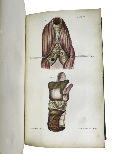 The Father of Laryngology in America - Image 5